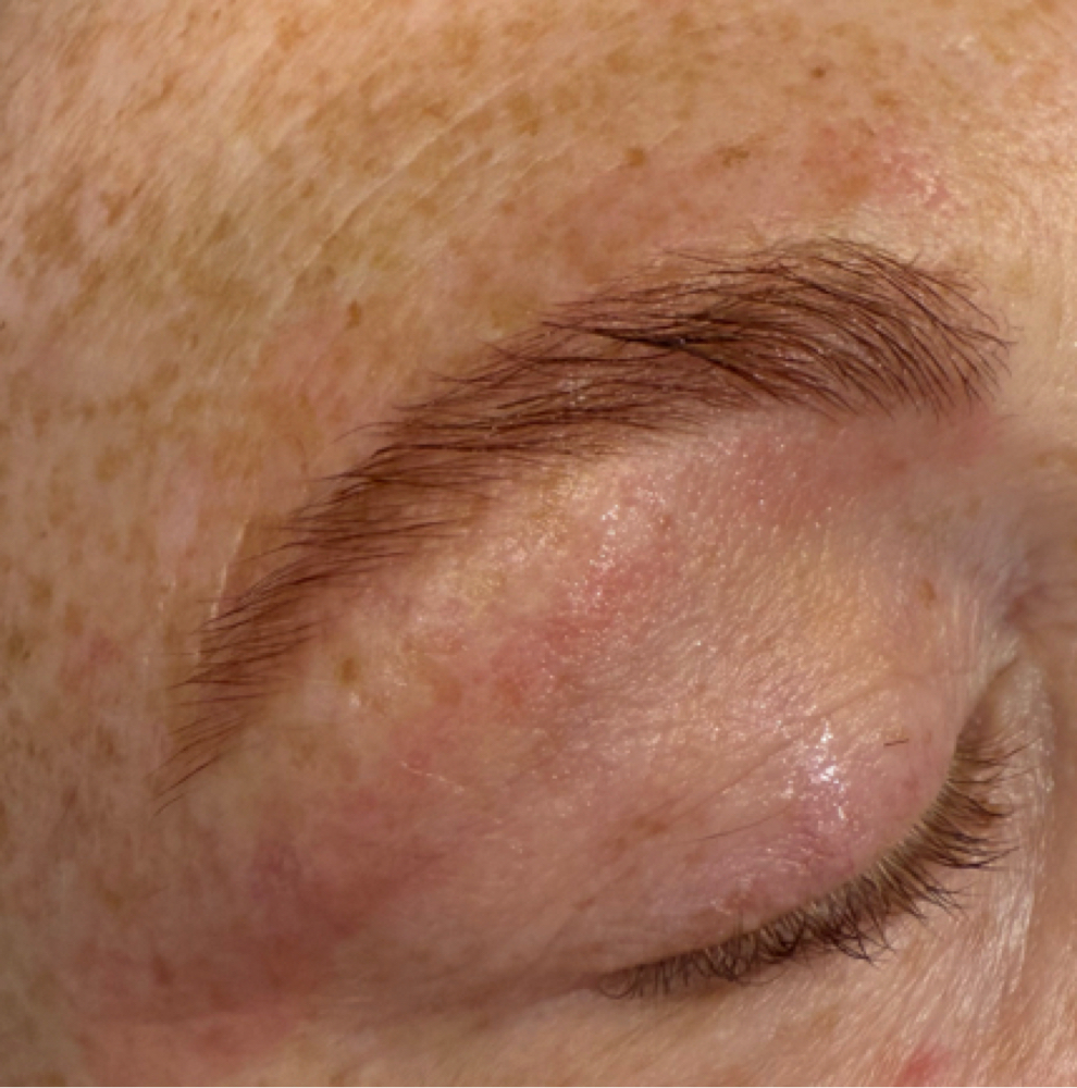 Brow Tint at Illuminate Dentistry & Aesthetics in St. Joseph, MO