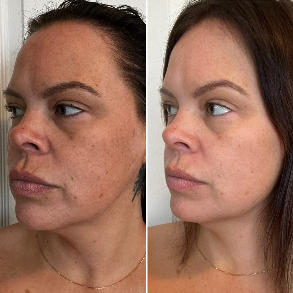 Carboxy Express Treatment (Add-On) at Amethyst | The Head Spa in Shreveport, LA