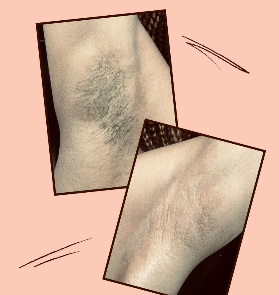 Underarm Wax