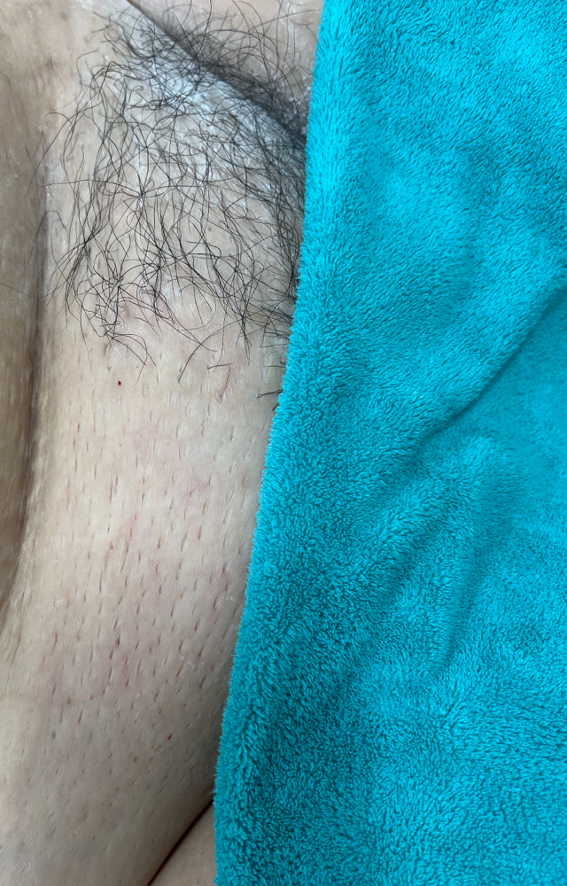Brazilian Wax
