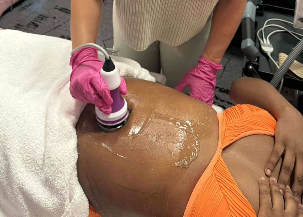 Ultrasound Cavitation at TNT Sculpting in Durant, OK