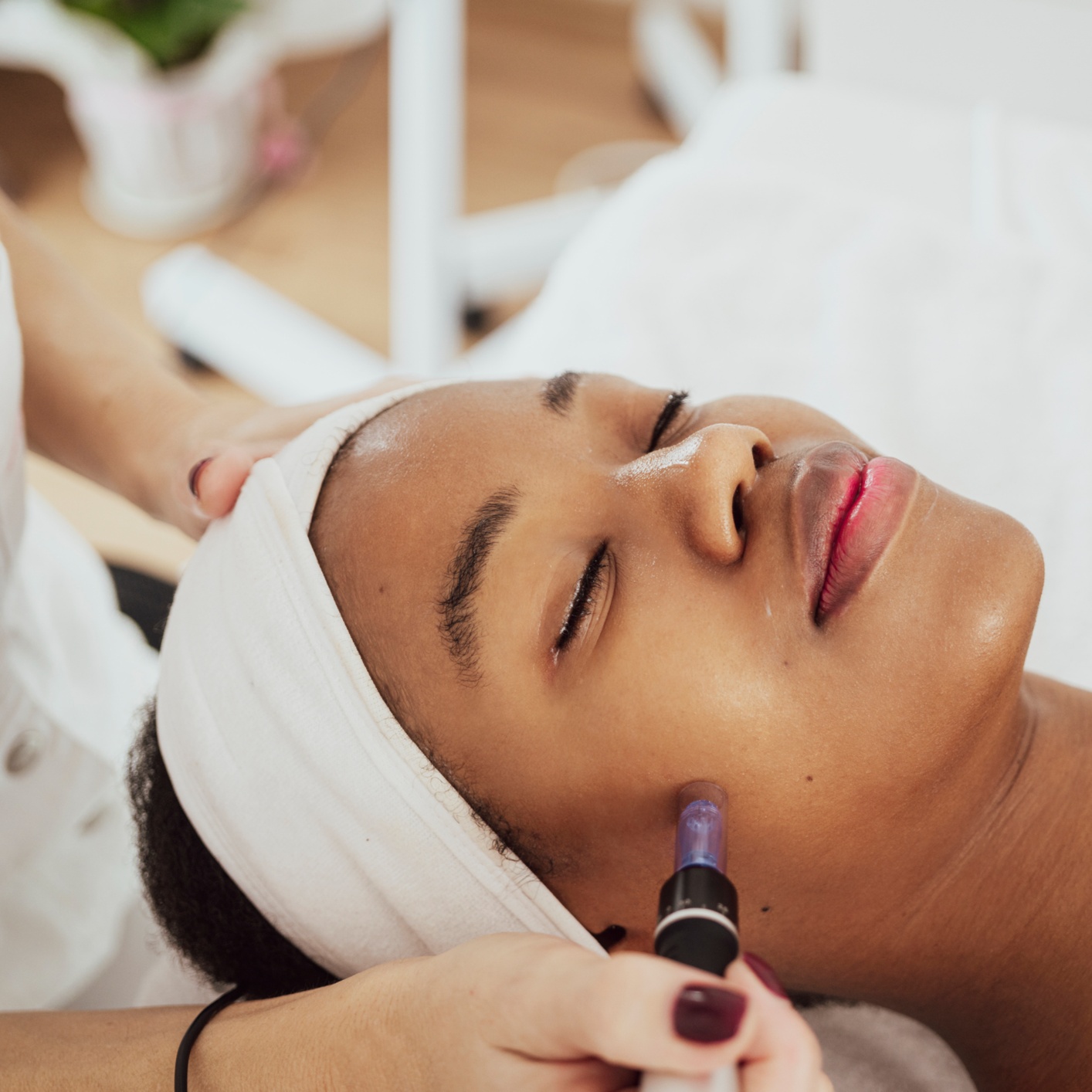 Microneedling at Evergreen Healthy Skin LLC in Philomath, OR