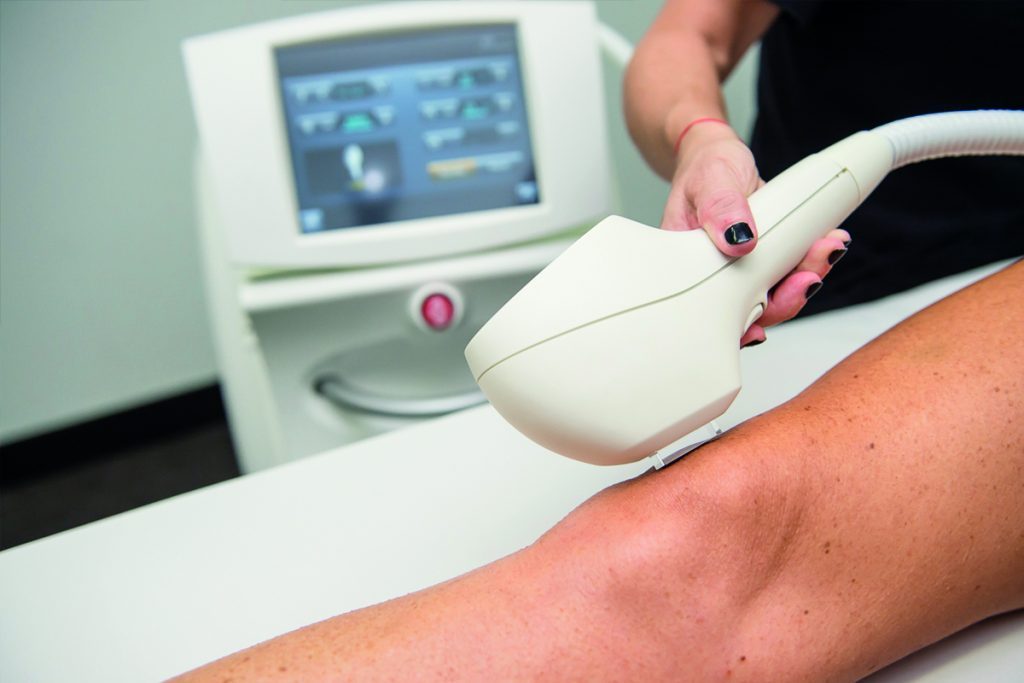 Laser Hair Removal Consultation