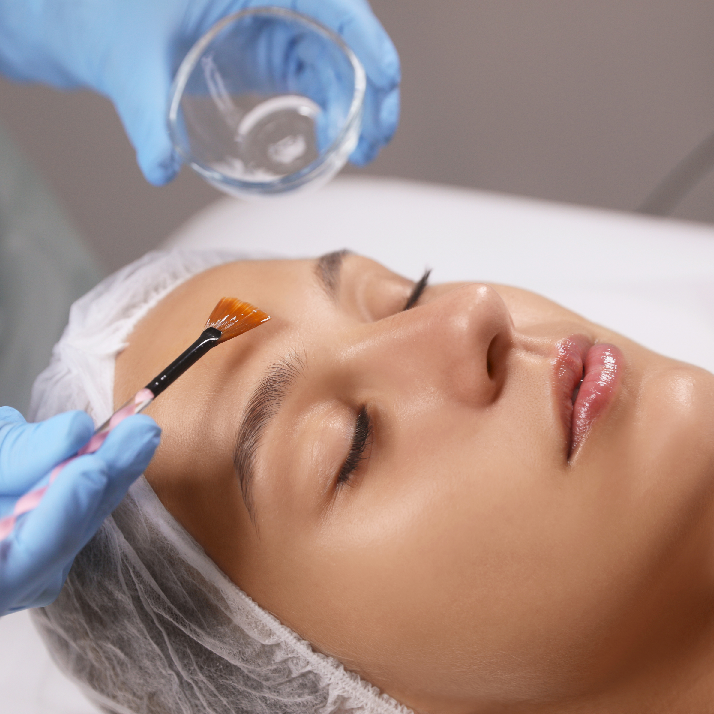 Radiance Peel | Glow & Texture at Arcana Med Spa in Castle Rock, CO