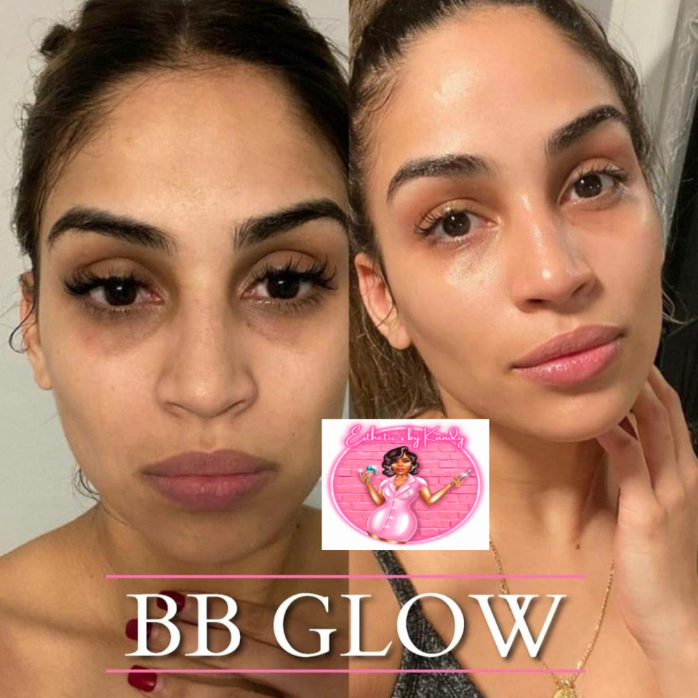 BB GLOW FACIAL