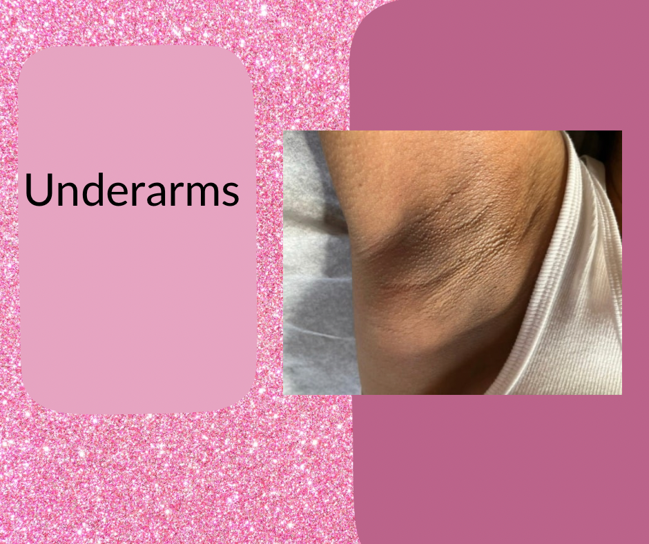 Underarms