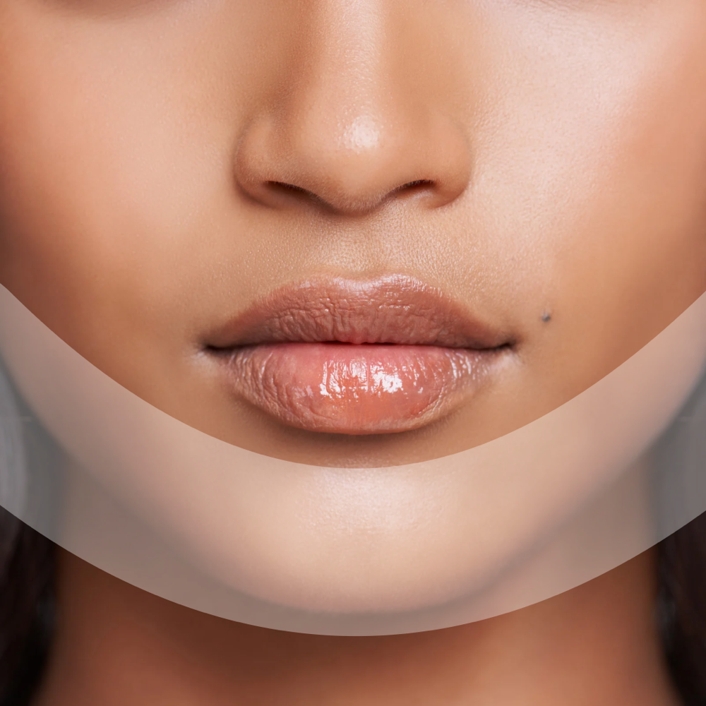 Chin + Lower Face