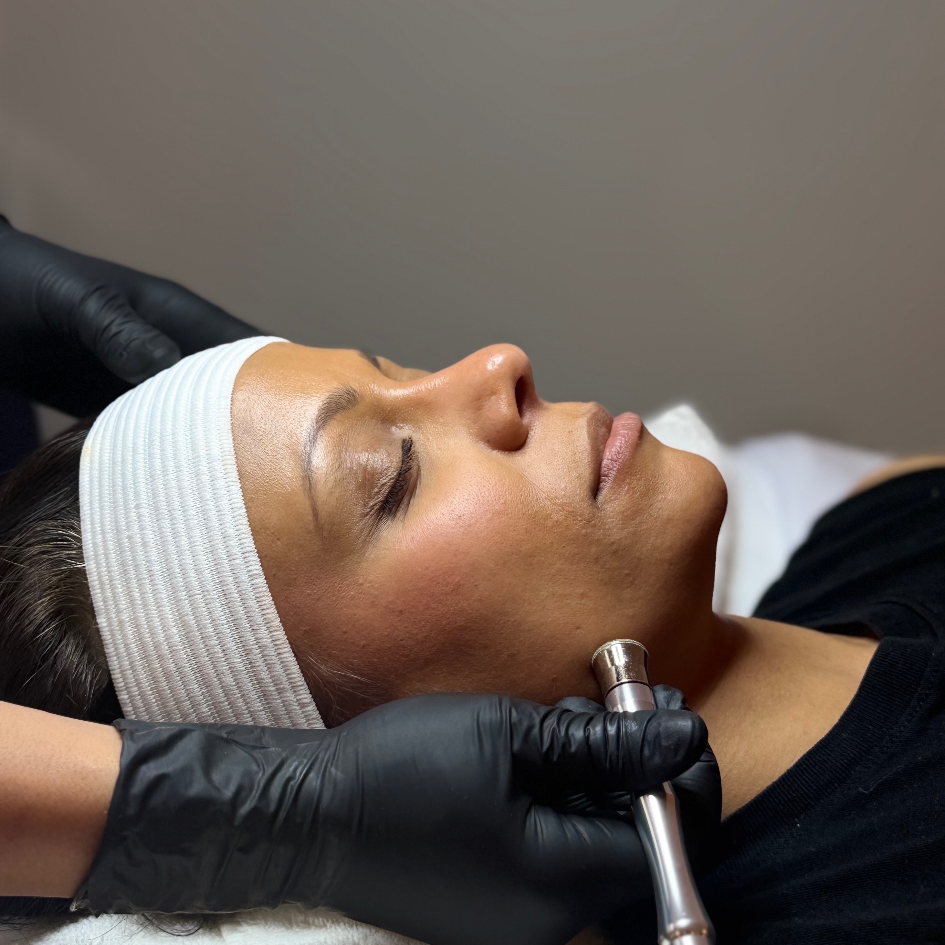 Microdermabrasion at Tillie's Skincare Studio in Rockland, MA