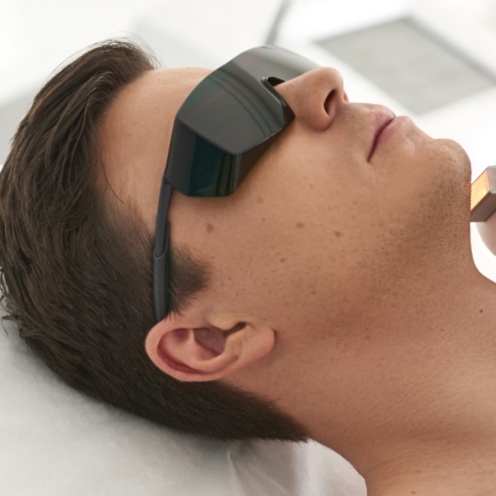 Gentlemen’s IPL - Redness at Empower Aesthetics in Canyon Lake, TX