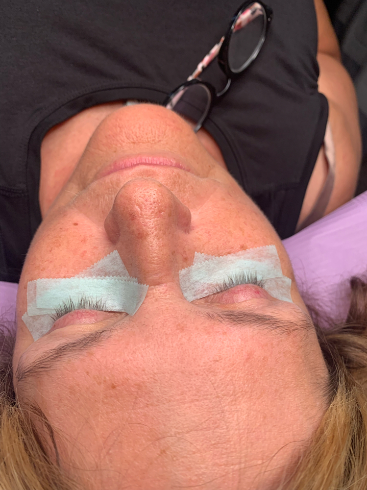 Eyelash Removal
