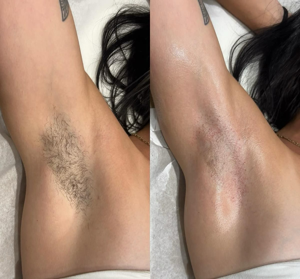 Underarm Wax