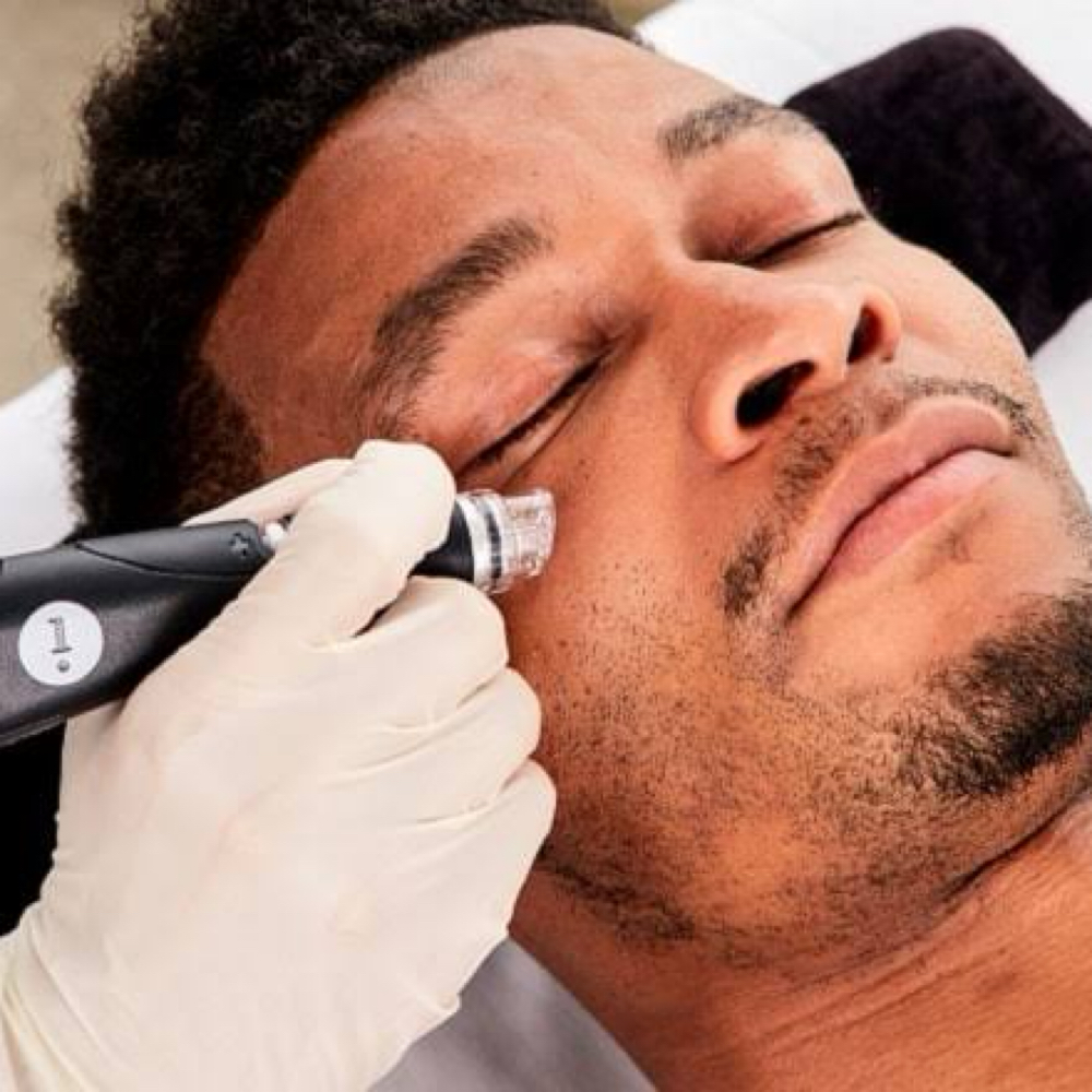 Men’s Facial W/ Ingrown Extraction at Pink Paradise Esthetics LLC in Mobile, AL