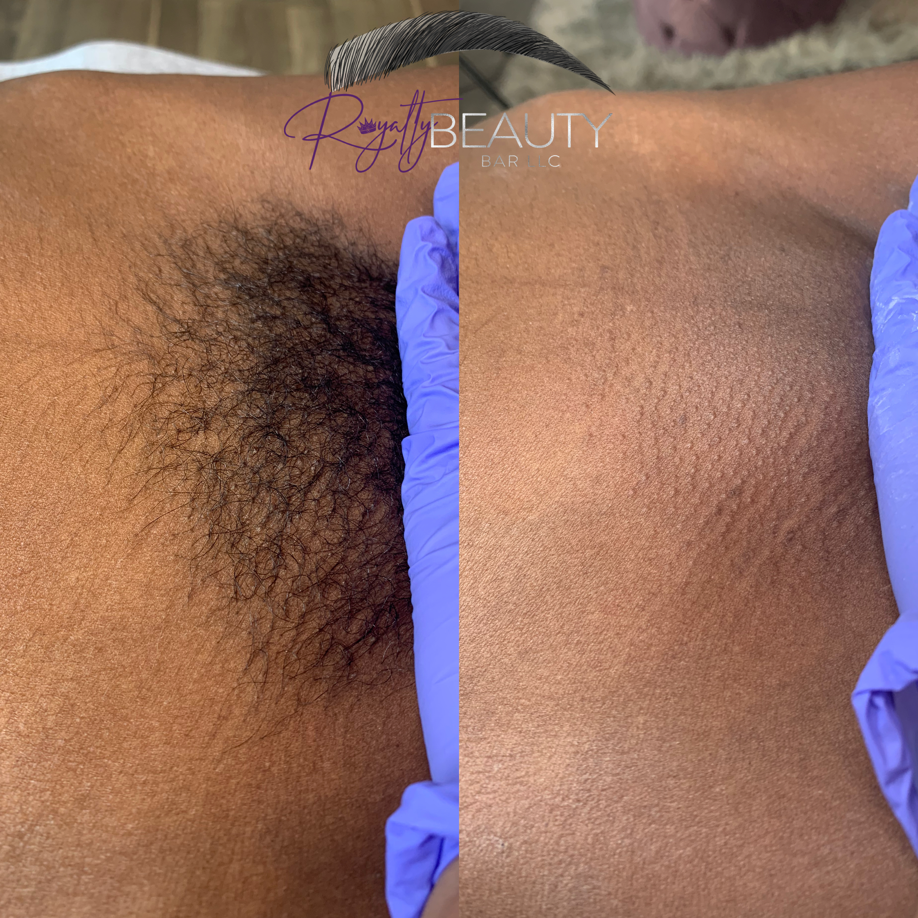 Brazilian Wax