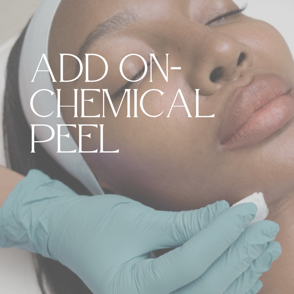 ADD ON - Chemical Peel