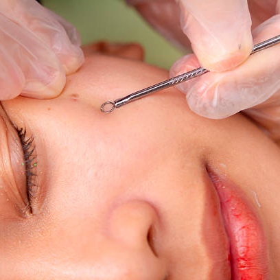 Ultrasonic cleanse and LED facial