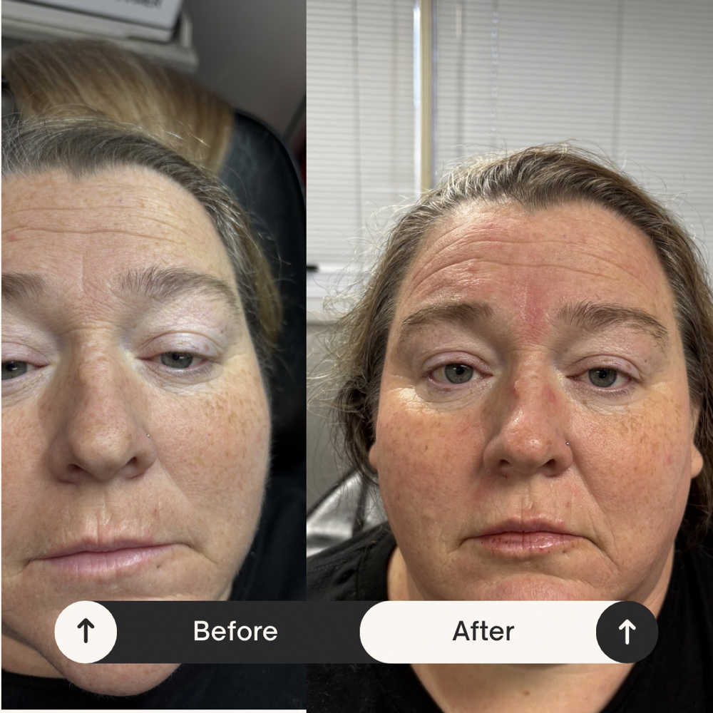 Deluxe Oxygen & Hydrogen Facial at Davis Wellness & Aesthetics in Cleburne, TX