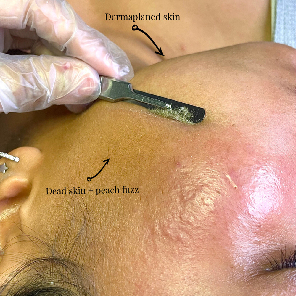 Signature Dermaplane Facial