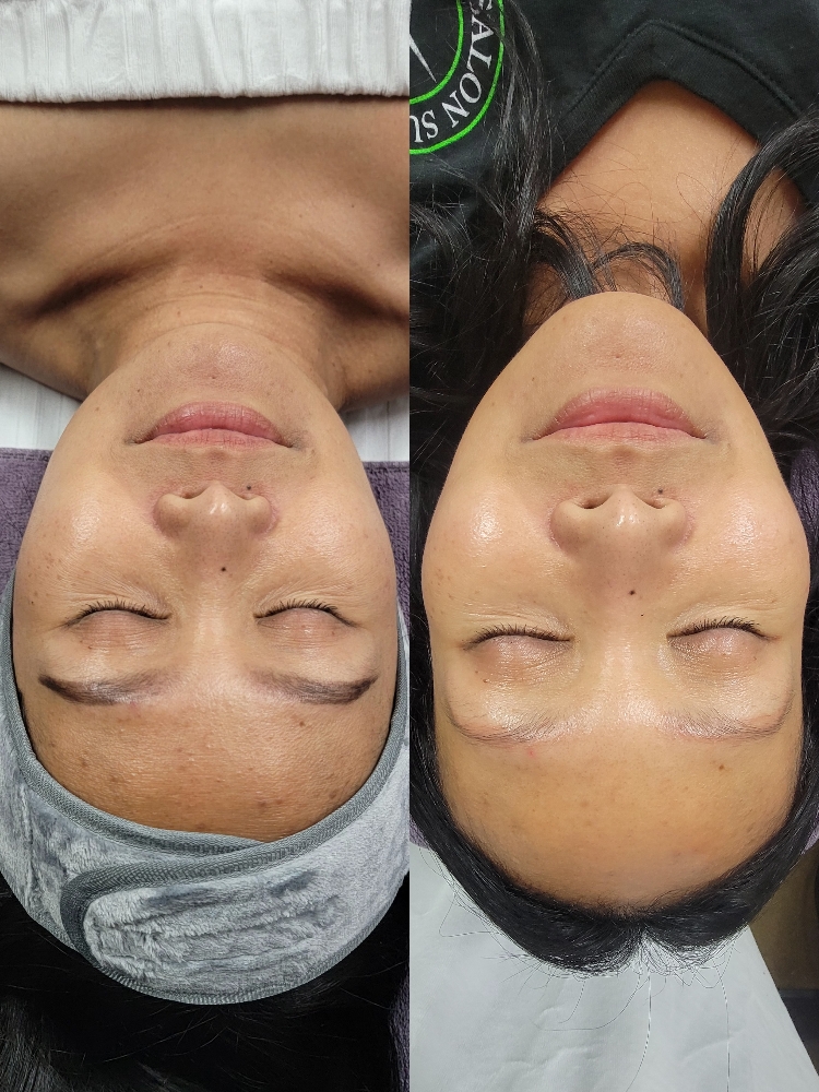 Basic Facial