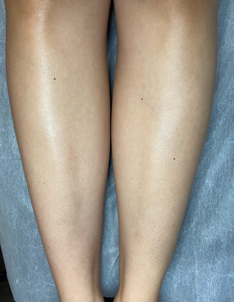 Full Legs