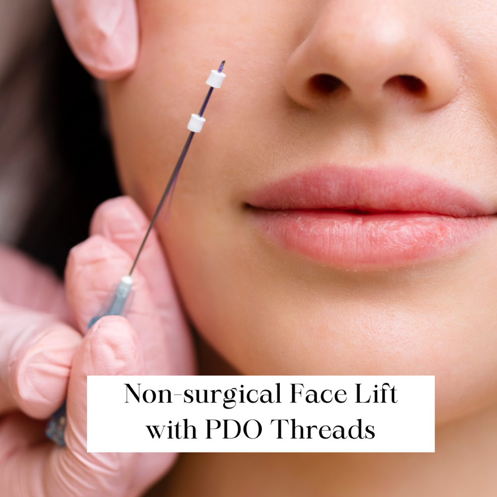 PDO Non-surgical Facelift