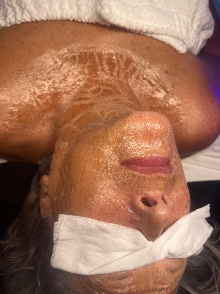 Circadia Beyond Botox