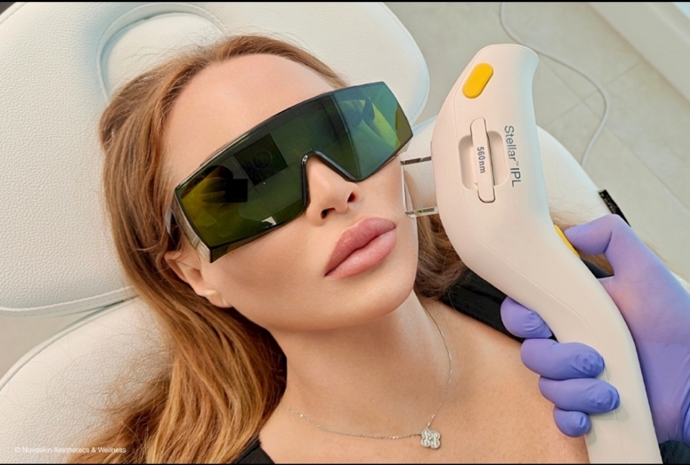 IPL  Pigmentation & Sun Spots