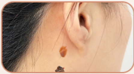 Patch Test