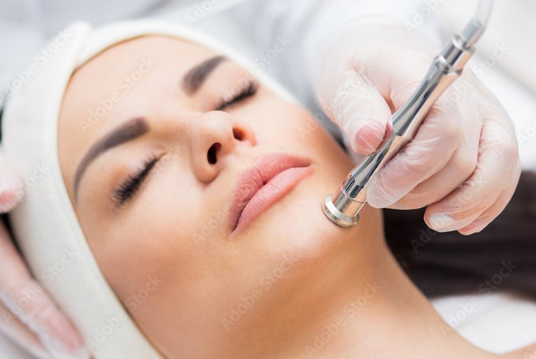 Microdermabrasion Facial