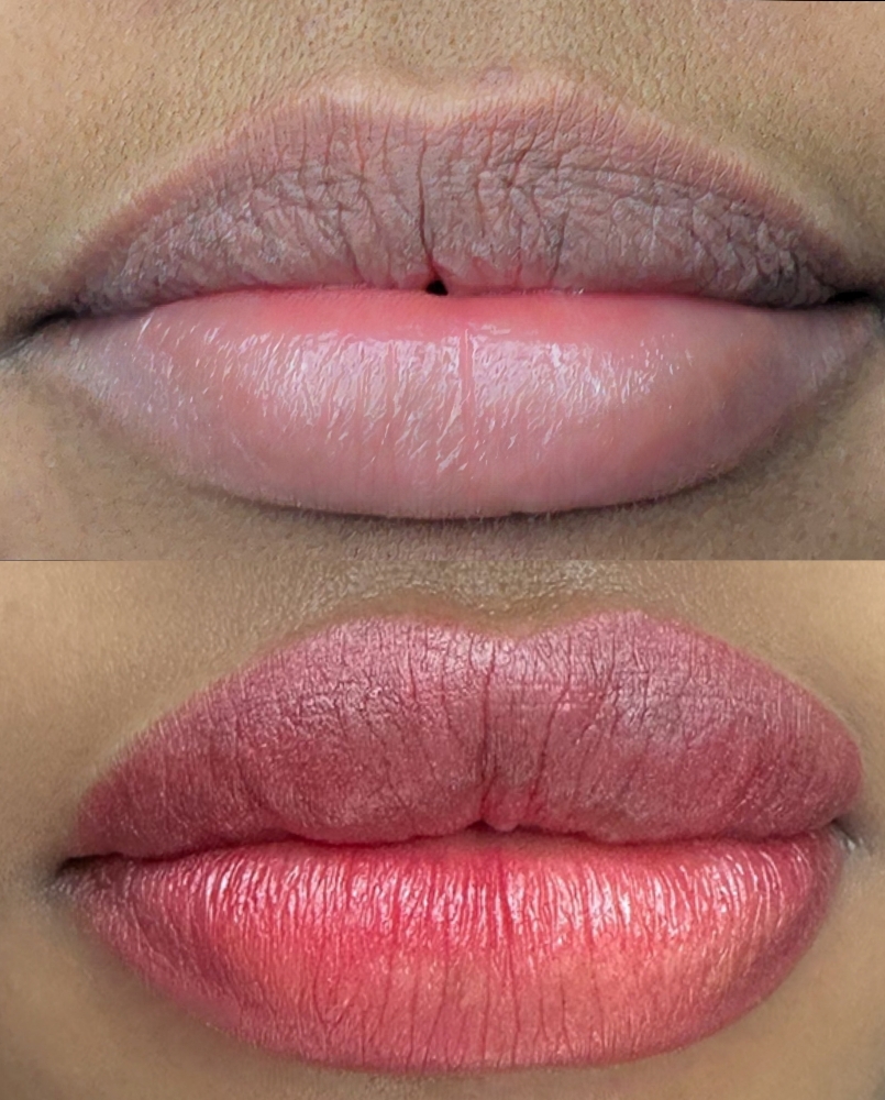 Dark Lips Corrections