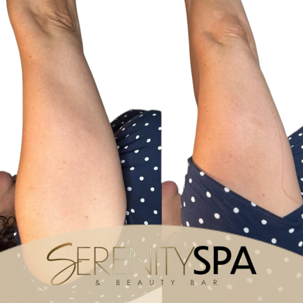 Snatch Me Up Combo (2 Areas) at Serenity Spa & Beauty Bar in Warwick, RI