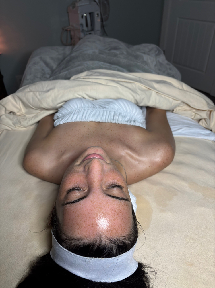 Renewal Facial-light  chemical peel