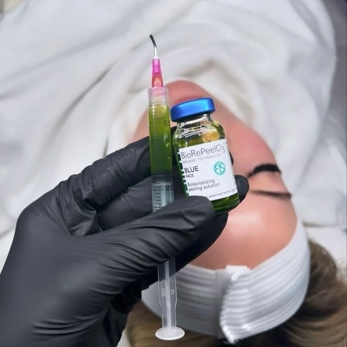 BioRePeel at Skin Fix Aesthetics LA in Studio City, CA