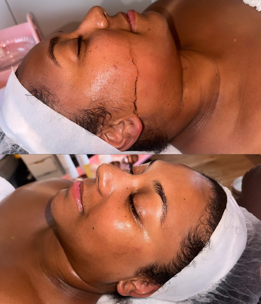 Dermaplaning Facial at Jewels Beauty in Fairview, NJ