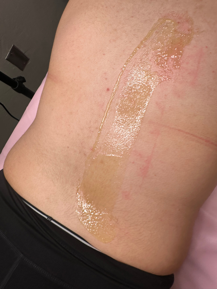 Undrer Arm + arm Or Back Wax