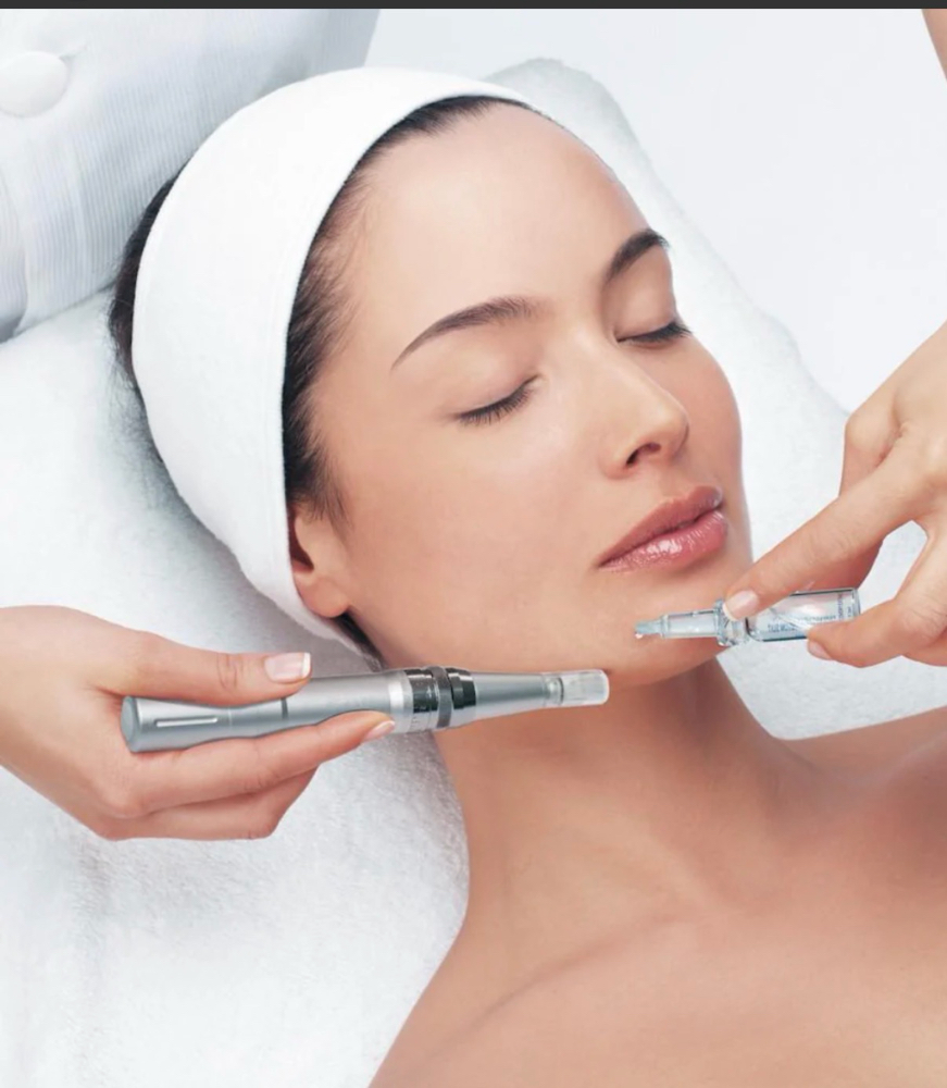 Microneedling Neck & Chest
