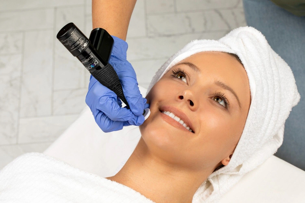 Microchanneling Treatment