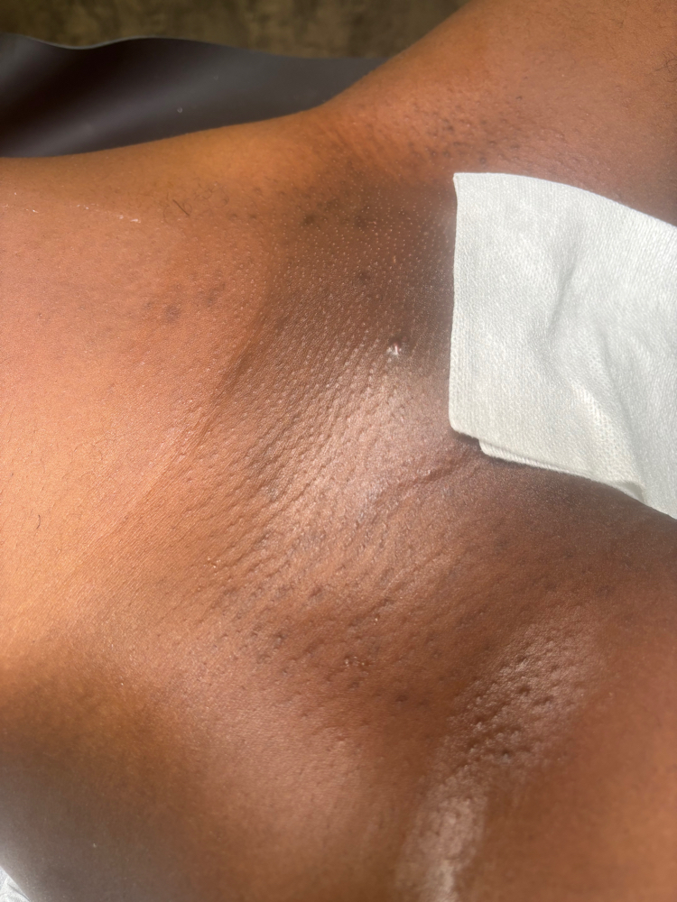 Brazilian(Sugar) (V) at Soleil Beauty Bar LLC in Hartford, CT