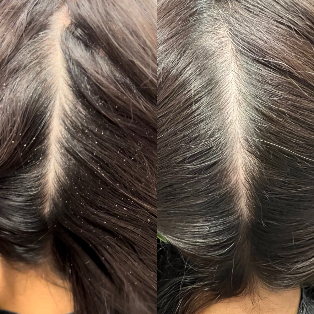 Scalp & Steam Treatment at Everything Beautiful Hair Studio in Dallas, TX