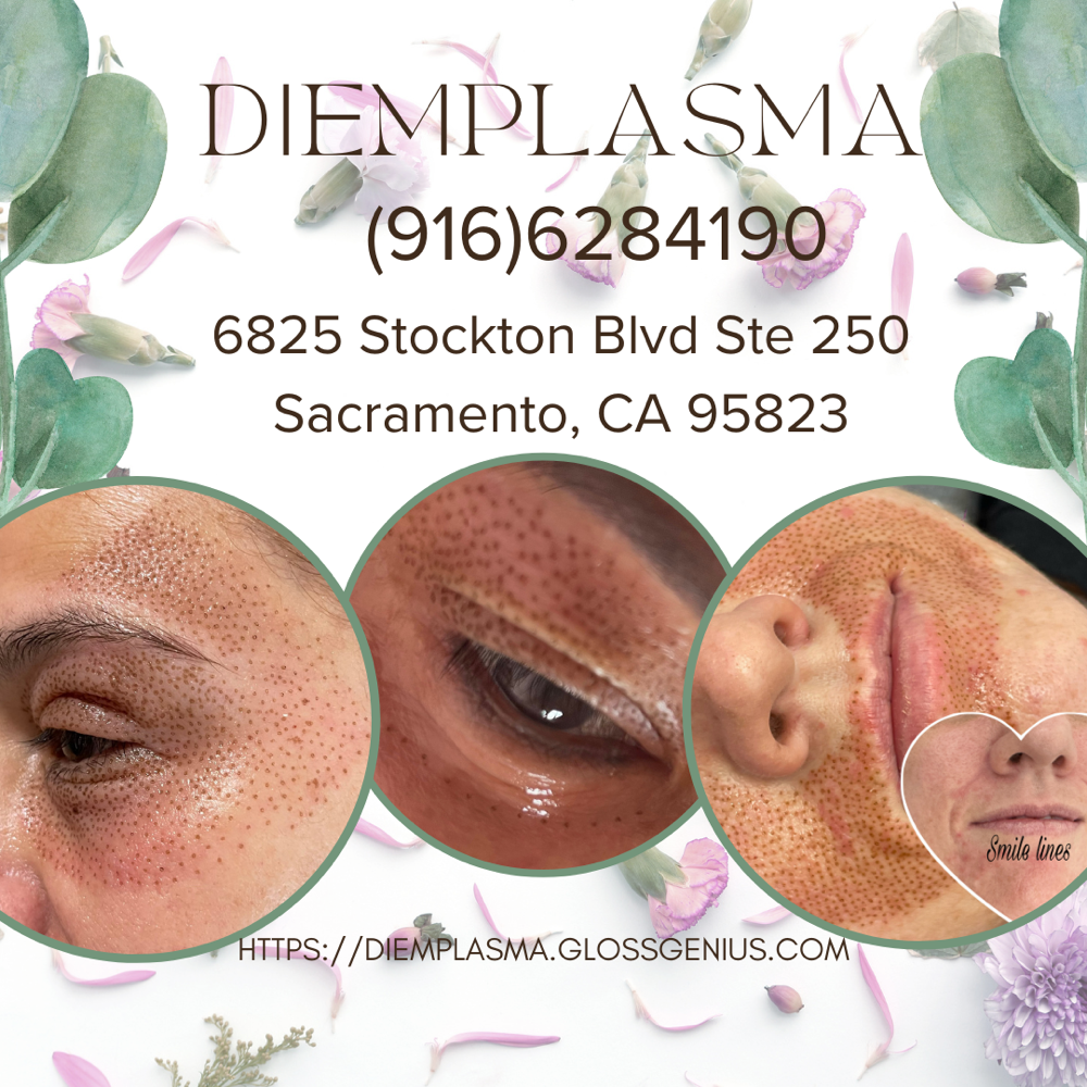 Upper Eyelids GP Voucher