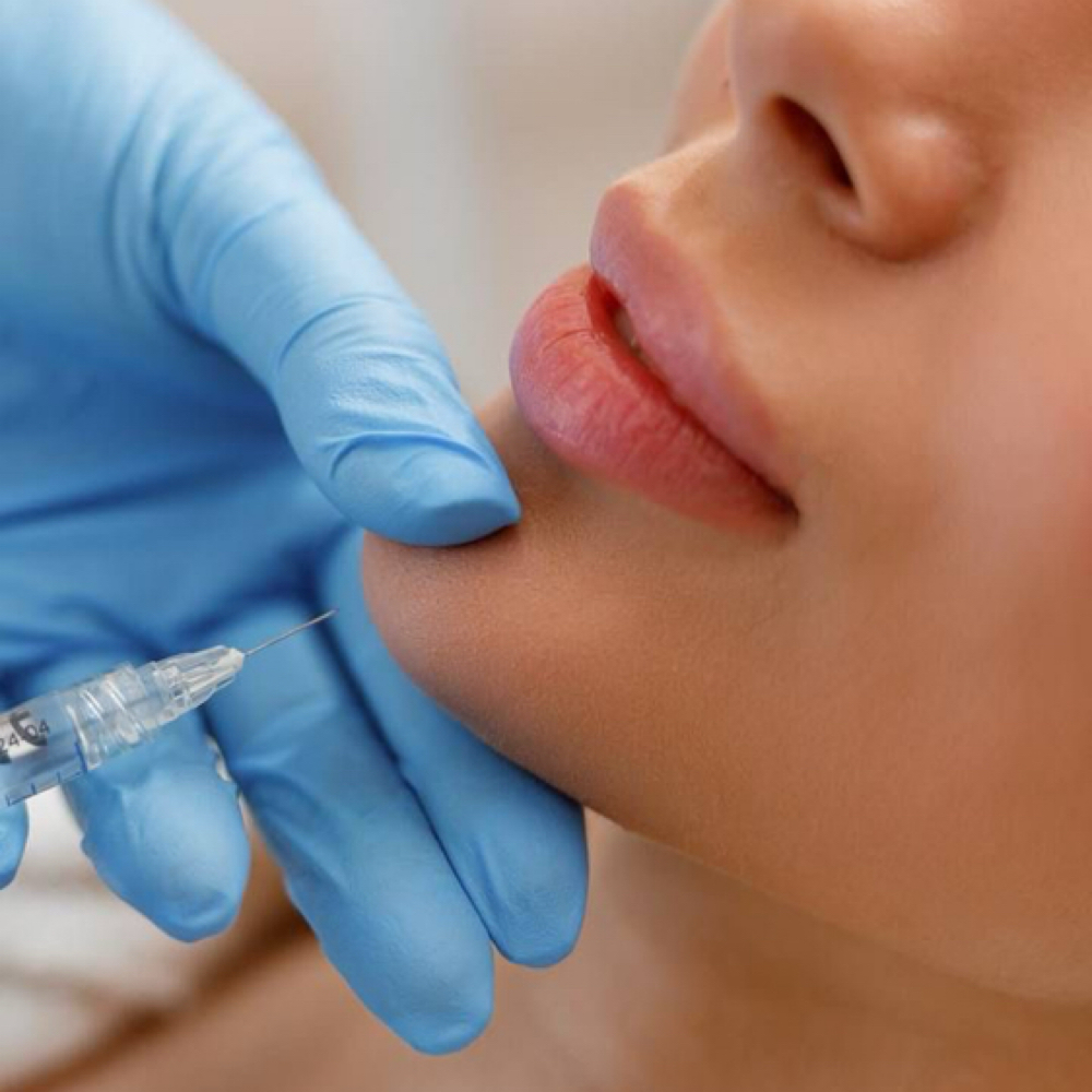 Chin Filler at Sharon Nicole Aesthetics in Patchogue, NY