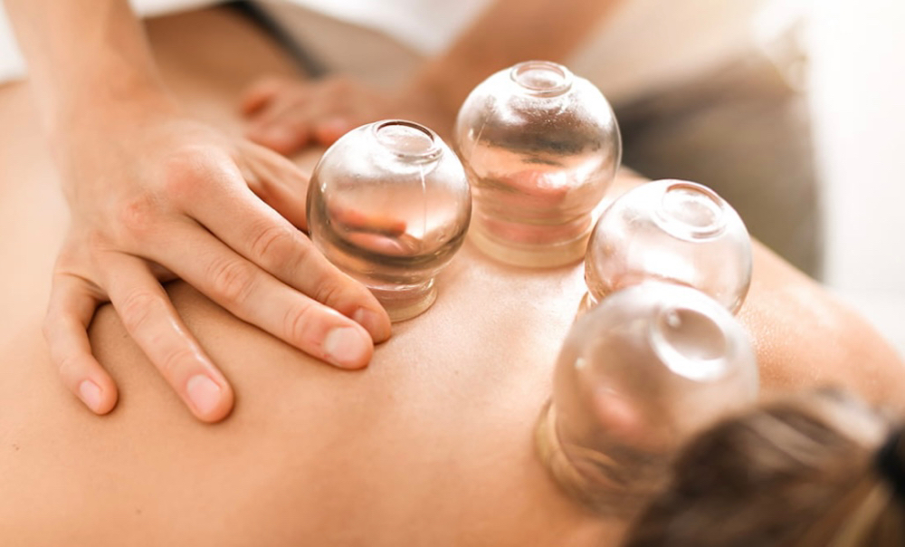 Fire Cupping therapy