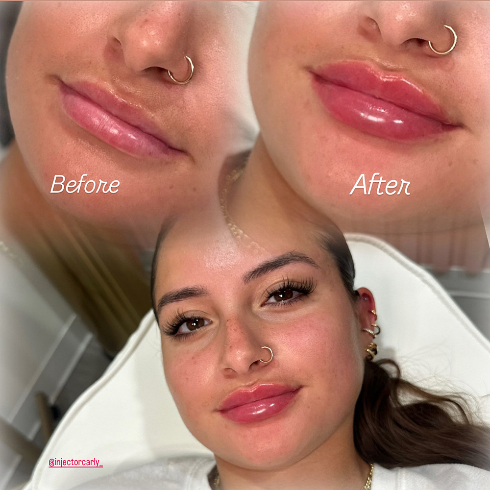 Mini Lip SUMMER SPECIAL 0.5ML