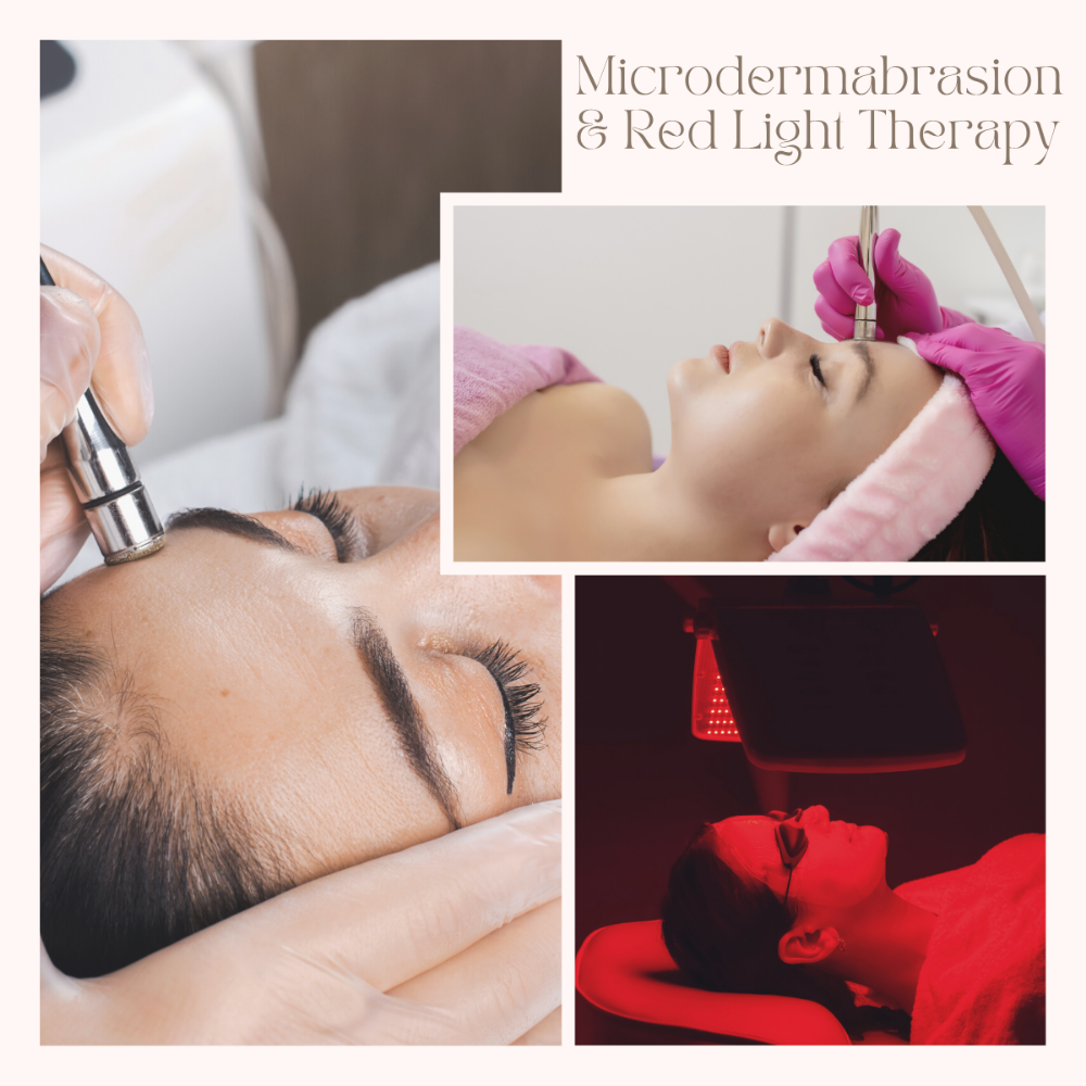 Basic Microdermabrasion W/ Red Ligh