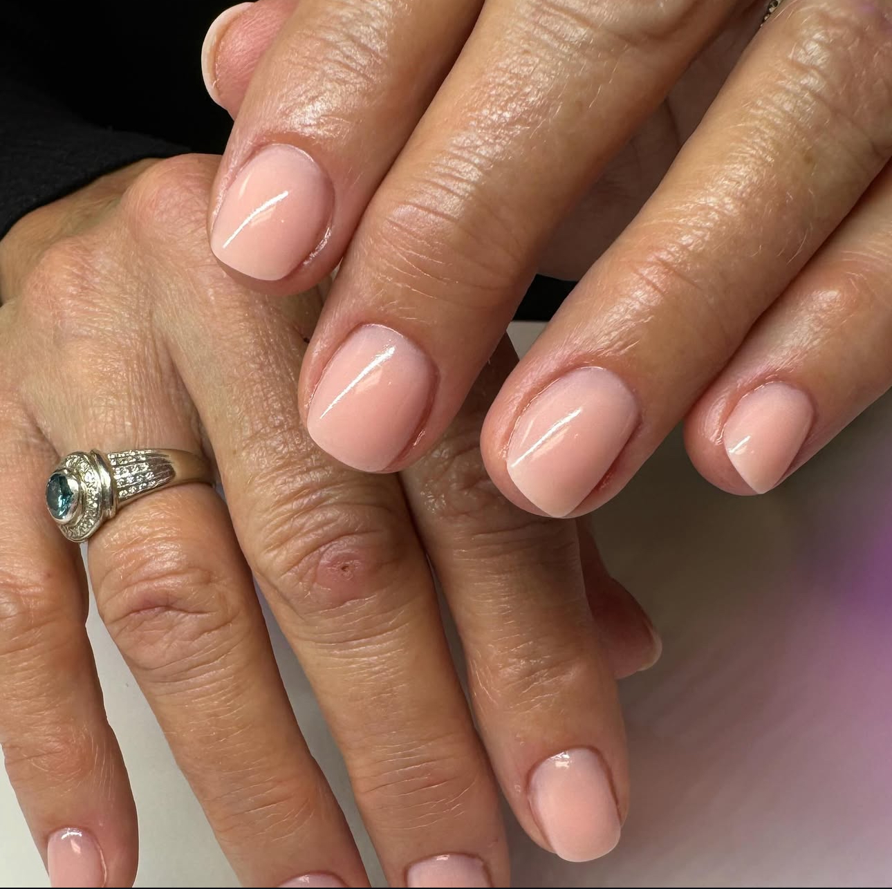 Gel Overlay