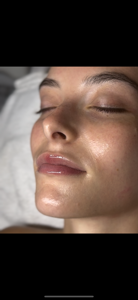 MesoJet Lip Plumping Infusion