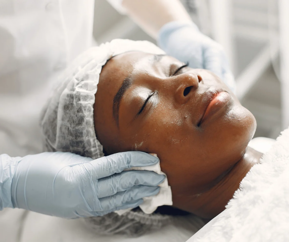 Hyperpigmentation Facial