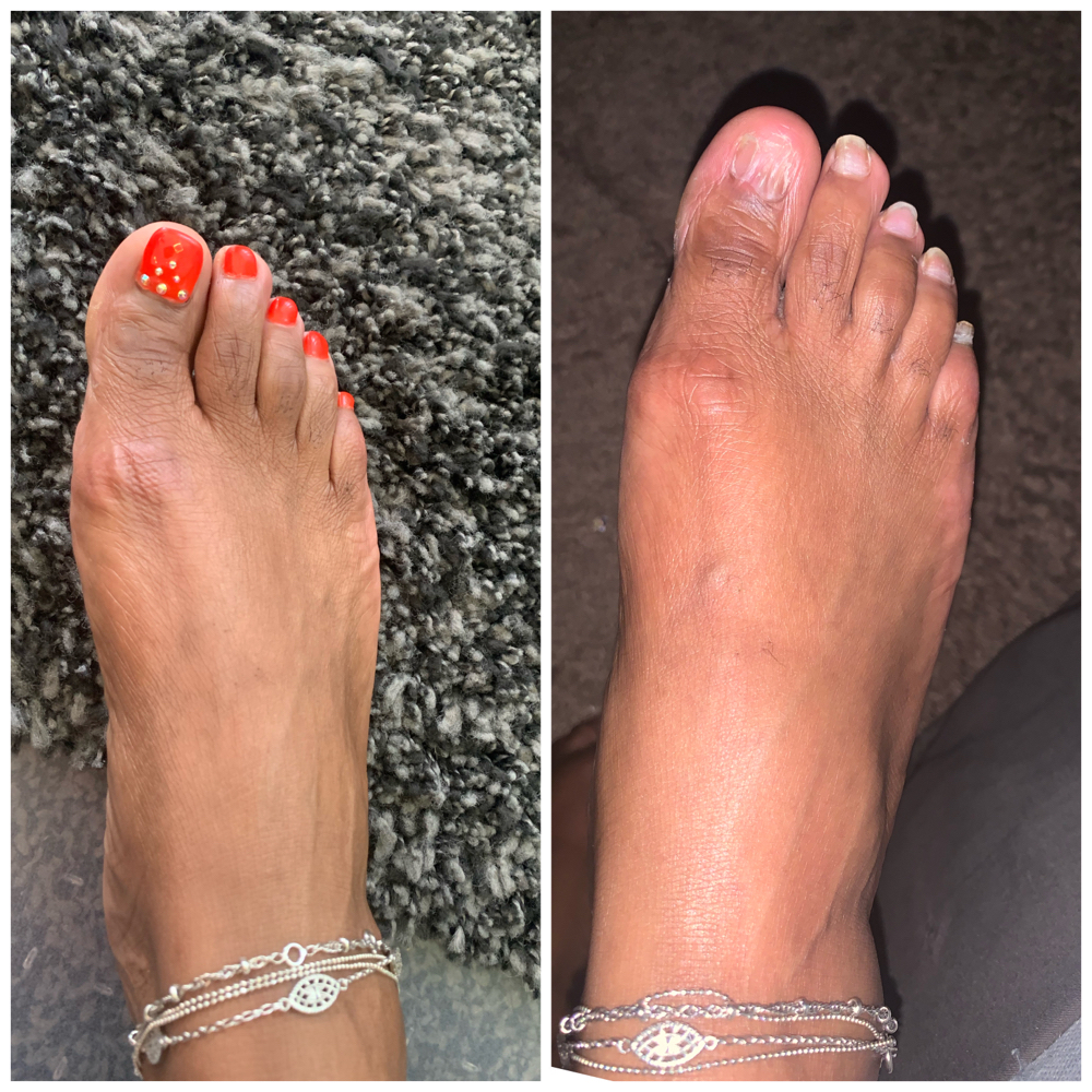 Acrylic Big Toes