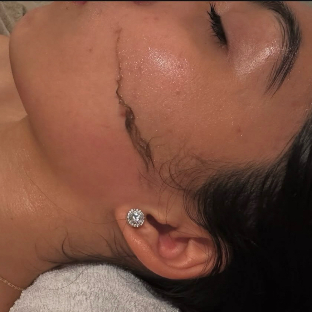 Dermaplaning at Beauty By Ivonne in Sierra Vista, AZ