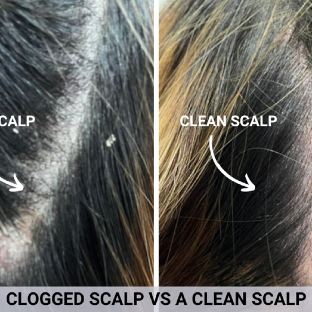 Scalp Exfoliation Therapy at L&O BeautyCollection in West Burlington, IA