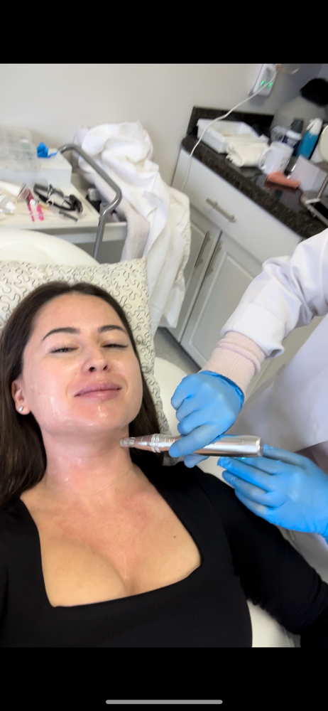 Neck Add-On for Micro-Needling